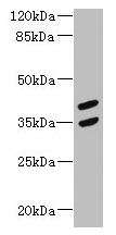 MAGEB10 Antibody