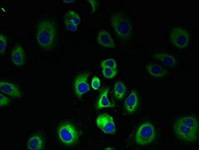 SLC7A3 Antibody