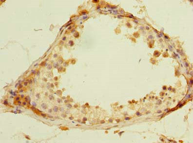 ROPN1L Antibody
