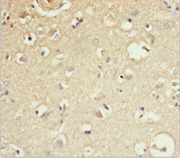 GAS2L1 Antibody
