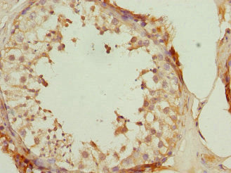DUSP22 Antibody