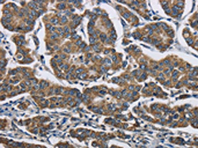 AGER Antibody