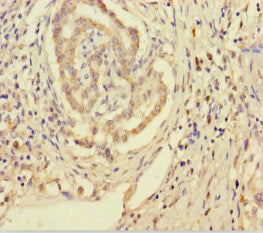 SMPD3 Antibody