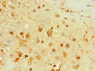 IFIH1 Antibody