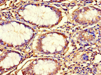 C12orf65 Antibody