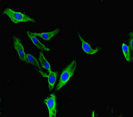BAZ2A Antibody