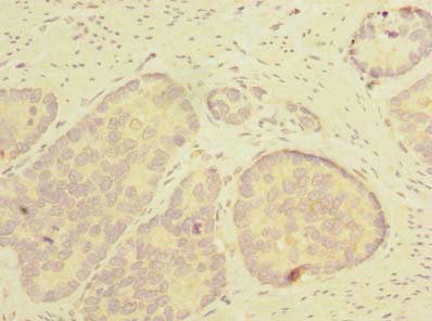 THTPA Antibody