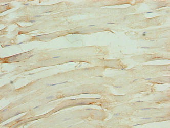 OSBPL6 Antibody