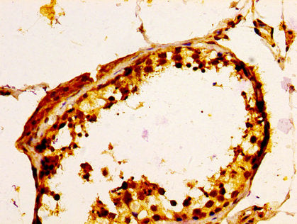 ULBP1 Antibody