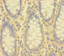 IL1RL2 Antibody