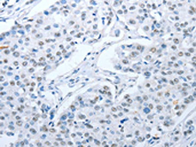 ARHGEF2 Antibody