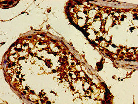 DKKL1 Antibody