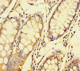 NDUFAF1 Antibody