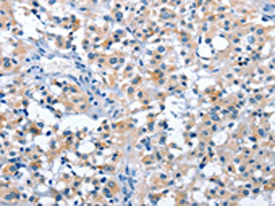 ASB2 Antibody