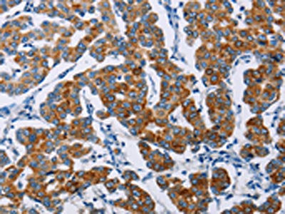 NCR3 Antibody
