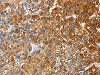 CD200R1 Antibody