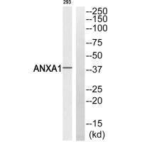 ANXA1 (Ab-21) Antibody