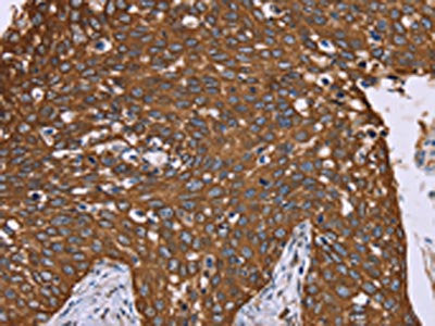 PPIB Antibody