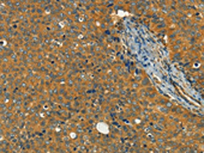 KLC1 Antibody