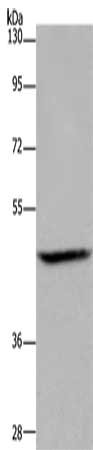 ETS2 Antibody