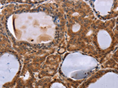 NDUFA2 Antibody