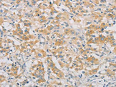 SPTLC1 Antibody