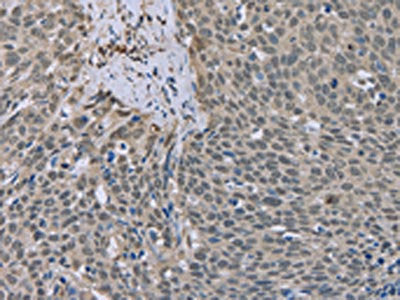 ESR2 Antibody