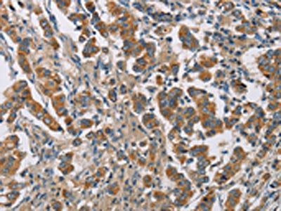 CYP4A11 Antibody