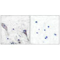 PTCH1 Antibody