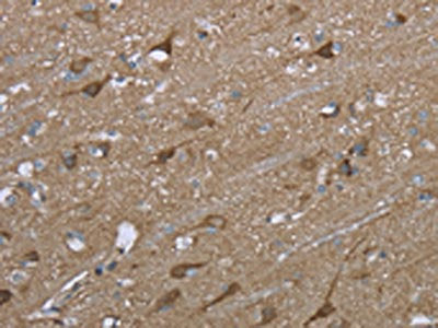 PTK2B Antibody