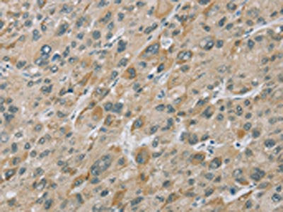 EIF5 Antibody