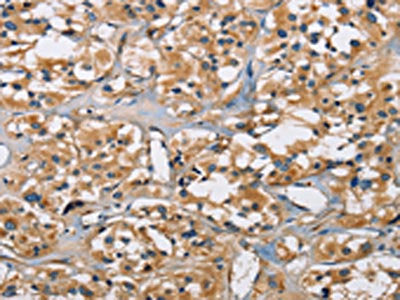PPP3CA Antibody