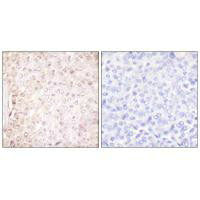 CSTB Antibody