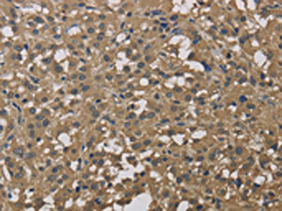 DCTN3 Antibody
