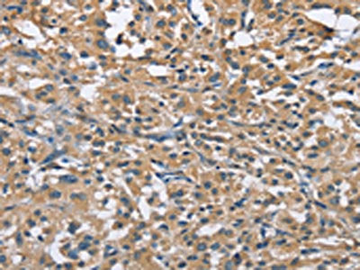 FLT3 Antibody