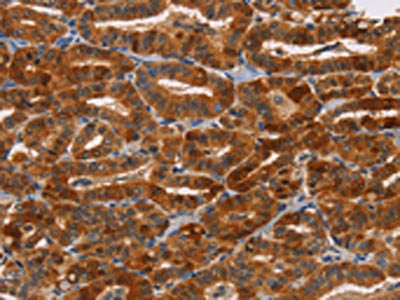 NCR1 Antibody