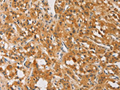 ATG4D Antibody