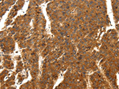 SCN11A Antibody