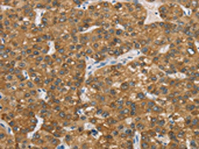 ENTPD5 Antibody