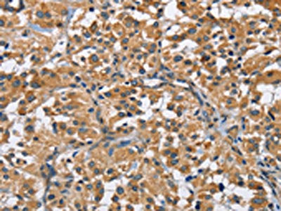 FLT3 Antibody