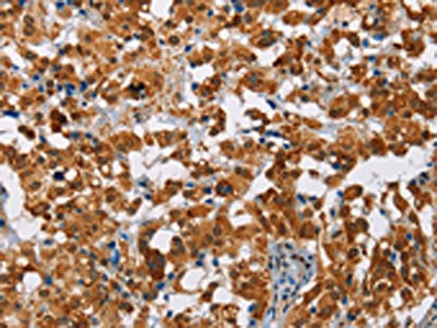 ATXN1 Antibody