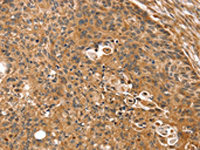 SSX2IP Antibody