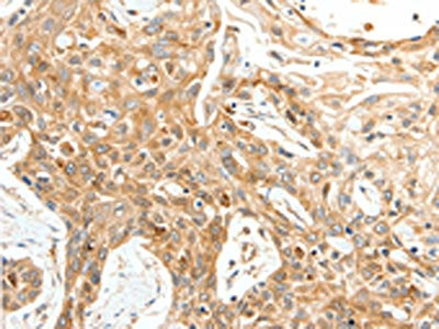TPM2 Antibody
