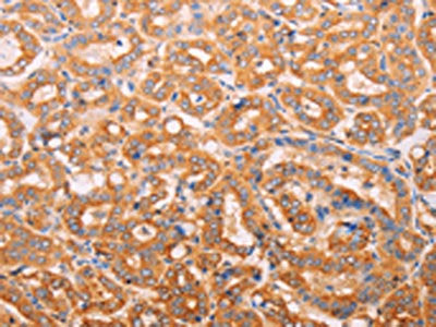 ADH1B Antibody