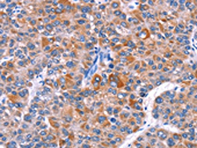 ELP2 Antibody