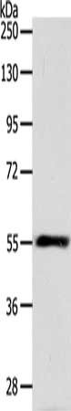 HNF1A Antibody