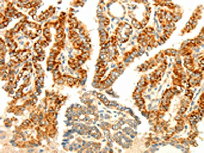 AARS2 Antibody