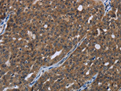 HOXC8 Antibody