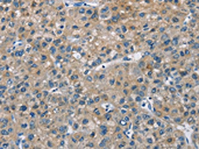 CAB39L Antibody