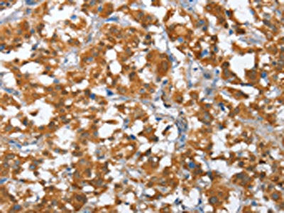 TP53BP2 Antibody